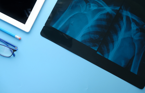 Desk with Radiography Image on Tablet