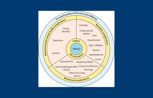 Circular obesity chart with navy blue background